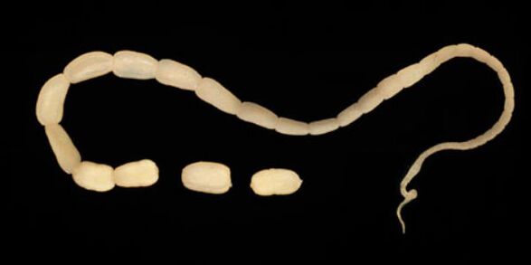 Anzeichen von Parasiten