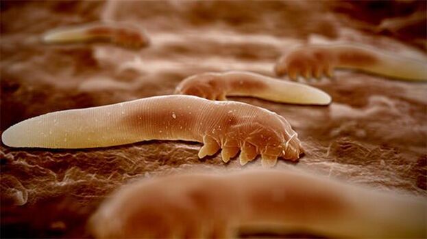Parasiten